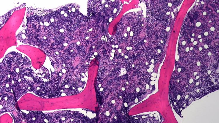 https://cdn.ncbi.nlm.nih.gov/pmc/blobs/ce5d/9946272/4d9fb5ddf901/cureus-0015-00000034093-i01.jpg