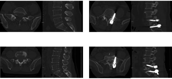 https://cdn.ncbi.nlm.nih.gov/pmc/blobs/ce65/11983563/e7f390771219/fsurg-12-1520481-g003.jpg
