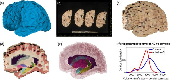https://cdn.ncbi.nlm.nih.gov/pmc/blobs/ce6b/11186625/cb68a7d8c851/elife-91398-fig1.jpg