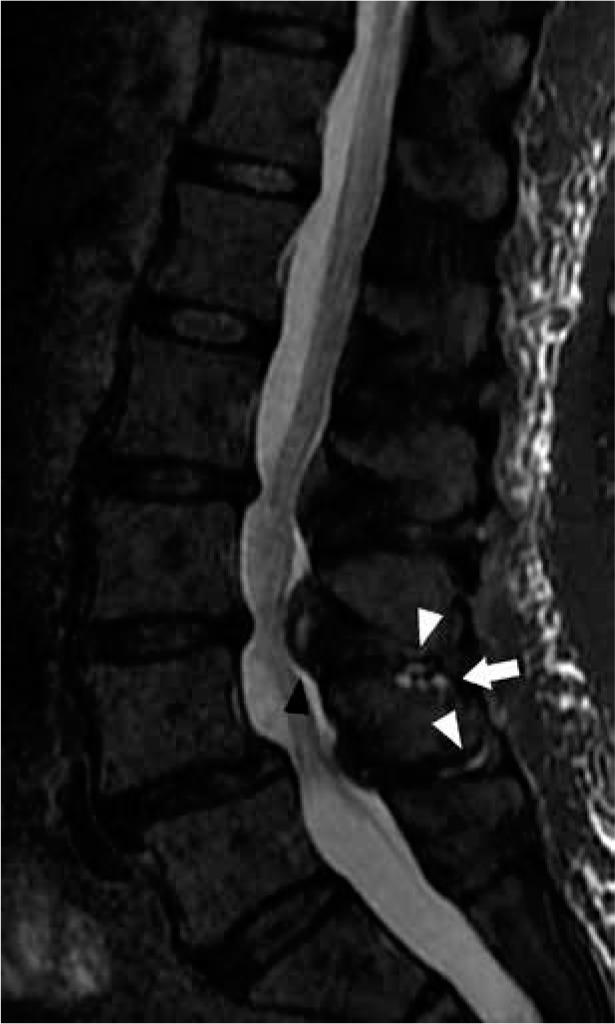 https://cdn.ncbi.nlm.nih.gov/pmc/blobs/ce6b/7571515/04789859a86f/PJR-85-42050-g021.jpg