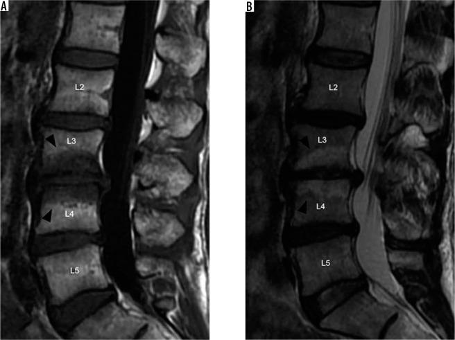 https://cdn.ncbi.nlm.nih.gov/pmc/blobs/ce6b/7571515/36e573e45dab/PJR-85-42050-g007.jpg