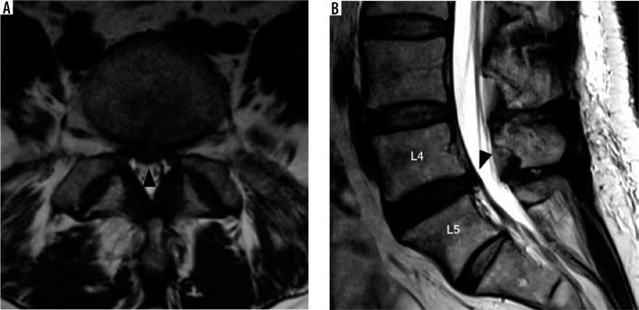 https://cdn.ncbi.nlm.nih.gov/pmc/blobs/ce6b/7571515/99ca758fe71e/PJR-85-42050-g011.jpg