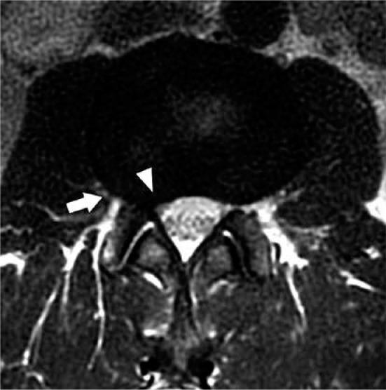 https://cdn.ncbi.nlm.nih.gov/pmc/blobs/ce6b/7571515/adda3a5de247/PJR-85-42050-g010.jpg