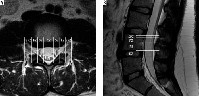 https://cdn.ncbi.nlm.nih.gov/pmc/blobs/ce6b/7571515/f4067bcc372d/PJR-85-42050-g014.jpg