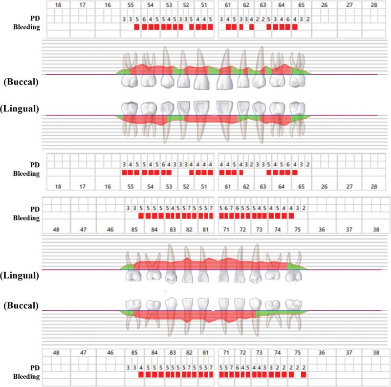 https://cdn.ncbi.nlm.nih.gov/pmc/blobs/ce74/11272339/c03825a04832/medi-103-e39086-g002.jpg