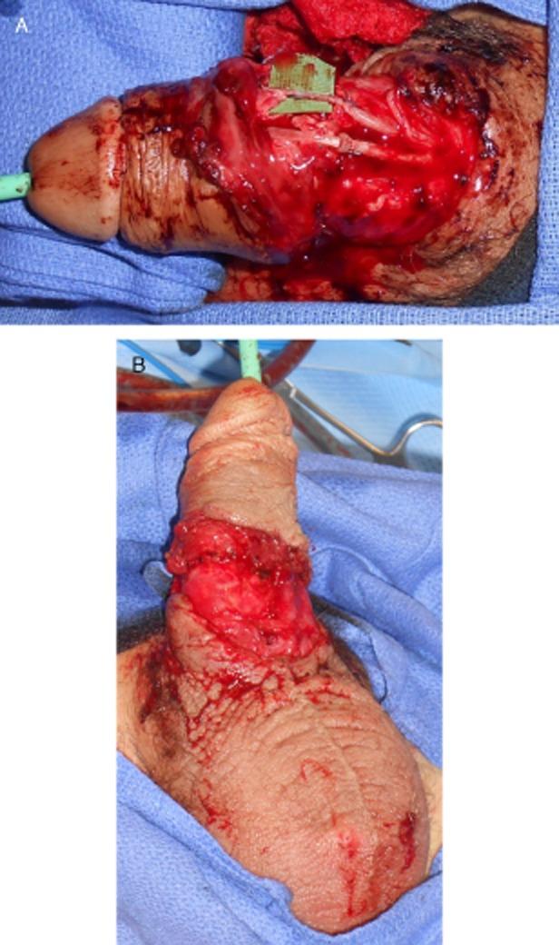 https://cdn.ncbi.nlm.nih.gov/pmc/blobs/ce77/4380914/2e735335abfd/sm20003-0049-f3.jpg