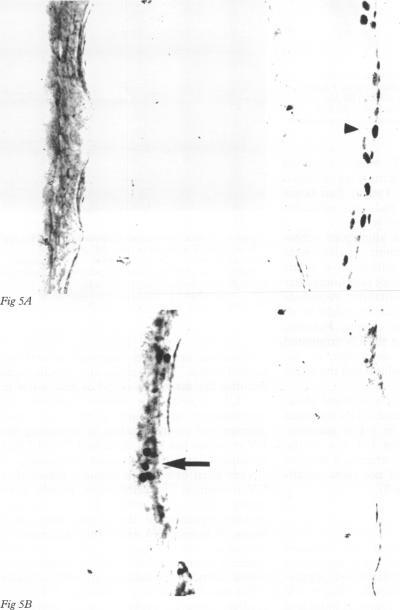 https://cdn.ncbi.nlm.nih.gov/pmc/blobs/ce7a/505079/3c5c2b05f04b/brjopthal00015-0082-b.jpg