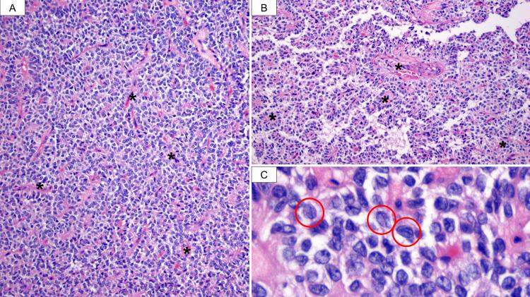 https://cdn.ncbi.nlm.nih.gov/pmc/blobs/ce84/11164693/361c32eca8c9/cureus-0016-00000060116-i05.jpg