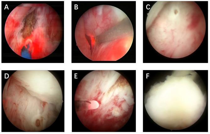 https://cdn.ncbi.nlm.nih.gov/pmc/blobs/ce87/12085318/e23cd0624670/10103_2025_4478_Fig1_HTML.jpg