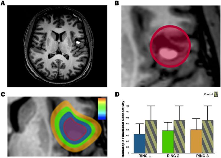 https://cdn.ncbi.nlm.nih.gov/pmc/blobs/ce87/6854067/fae1c5bb26a7/gr5.jpg