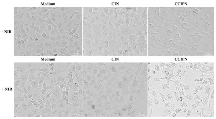 https://cdn.ncbi.nlm.nih.gov/pmc/blobs/ce92/10000418/71e6e41dd816/cancers-15-01576-g013.jpg