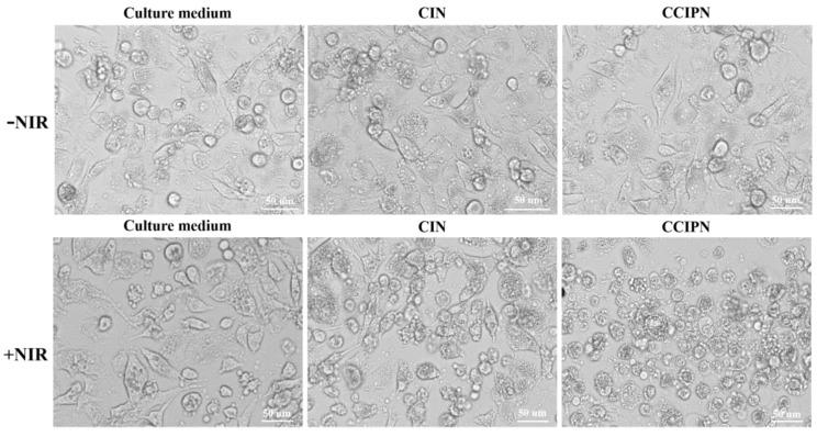 https://cdn.ncbi.nlm.nih.gov/pmc/blobs/ce92/10000418/c67165795469/cancers-15-01576-g011.jpg
