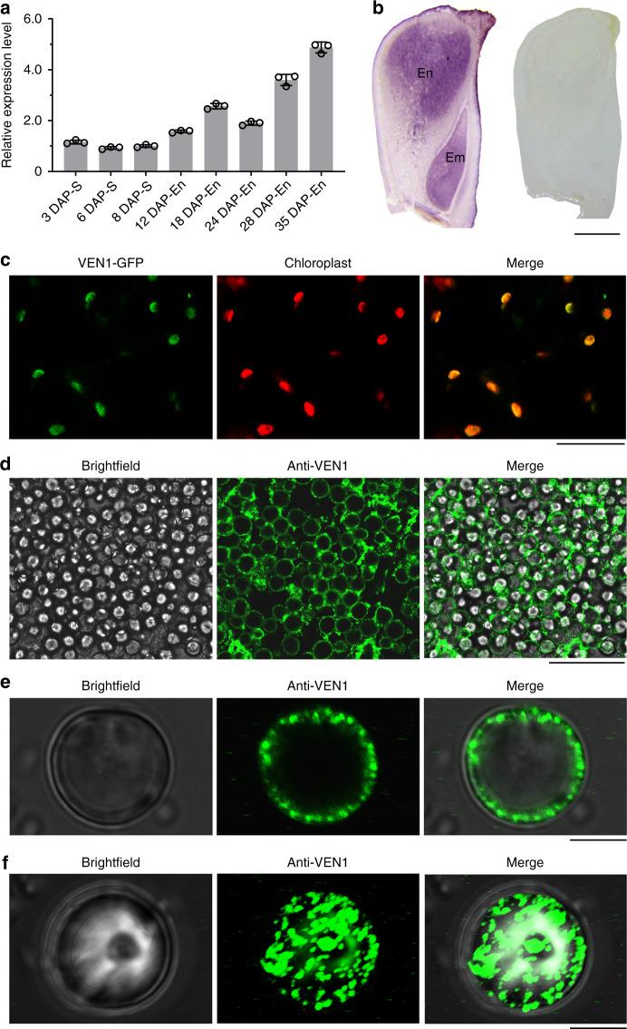 https://cdn.ncbi.nlm.nih.gov/pmc/blobs/ce92/7582188/4e482af8f712/41467_2020_19196_Fig2_HTML.jpg