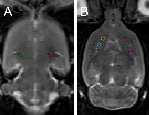 https://cdn.ncbi.nlm.nih.gov/pmc/blobs/ce98/5649470/2b0c3590cc88/NRR-12-1485-g004.jpg