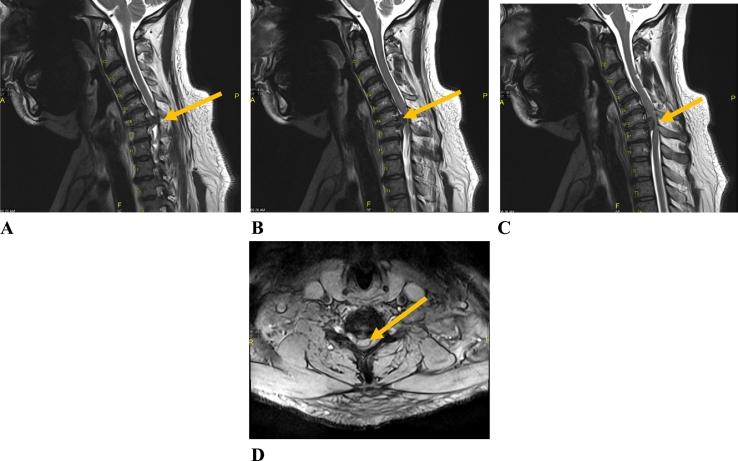https://cdn.ncbi.nlm.nih.gov/pmc/blobs/ce9f/8141523/aef0bdfff852/gr4.jpg