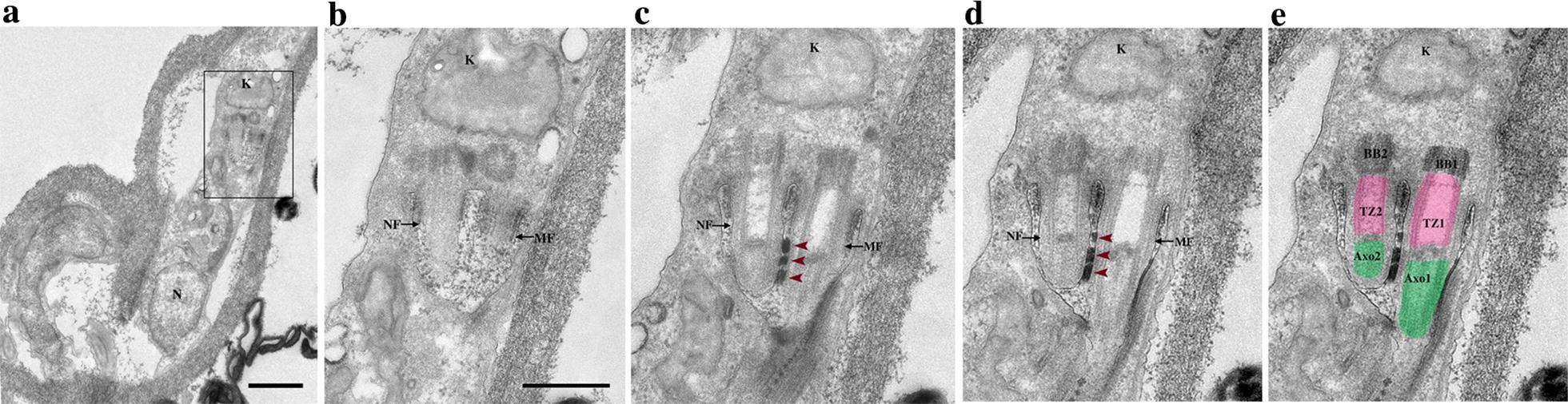 https://cdn.ncbi.nlm.nih.gov/pmc/blobs/cea6/7132888/9d6921f77850/13071_2020_4026_Fig6_HTML.jpg