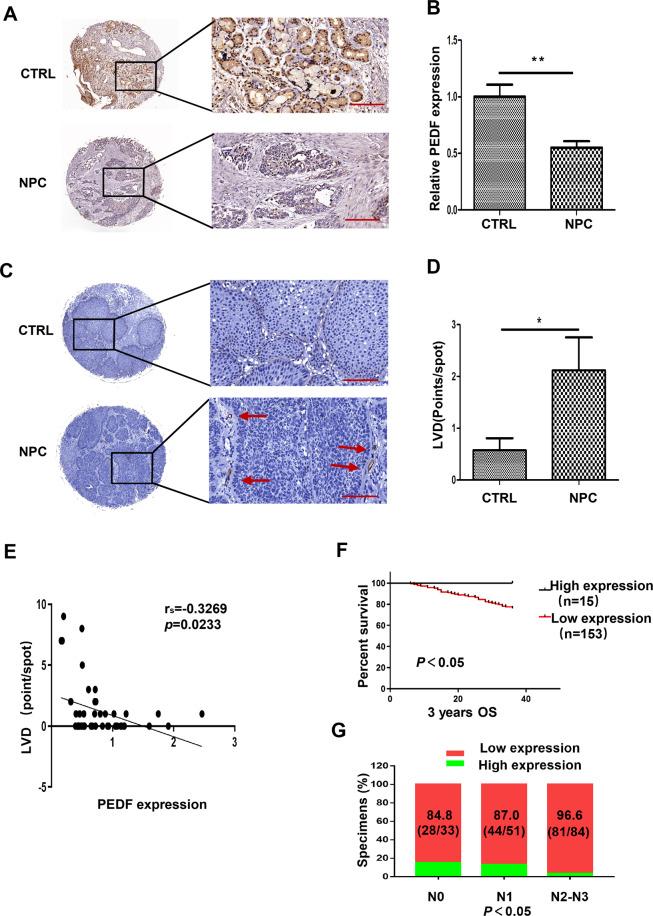 https://cdn.ncbi.nlm.nih.gov/pmc/blobs/cea8/7969934/ddf60675e2a5/41419_2021_3583_Fig1_HTML.jpg