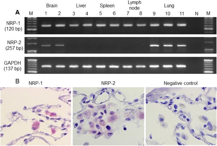 https://cdn.ncbi.nlm.nih.gov/pmc/blobs/cea9/4764655/f7b0f8142e0b/pone.0147358.g004.jpg