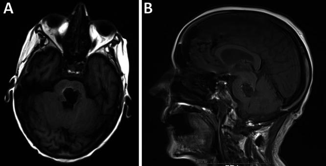 https://cdn.ncbi.nlm.nih.gov/pmc/blobs/cea9/9204912/324442ac762c/CASE21683f3.jpg