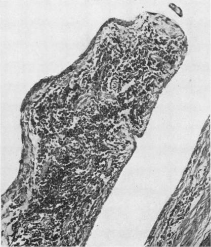 https://cdn.ncbi.nlm.nih.gov/pmc/blobs/ceac/1007168/da78965ae161/annrheumd00195-0076-b.jpg