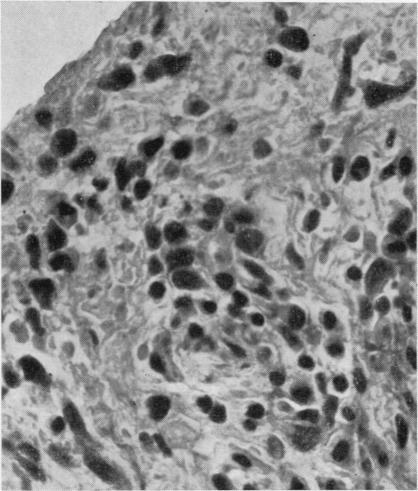 https://cdn.ncbi.nlm.nih.gov/pmc/blobs/ceac/1007168/db6471762388/annrheumd00195-0078-a.jpg