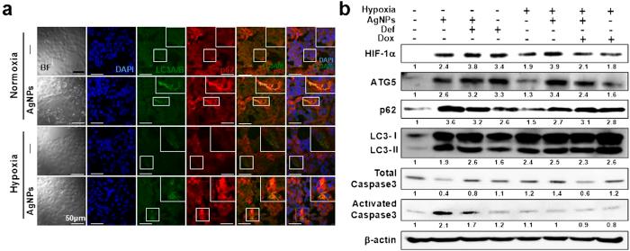 https://cdn.ncbi.nlm.nih.gov/pmc/blobs/ceb1/4751501/80db0ada602f/srep21688-f5.jpg