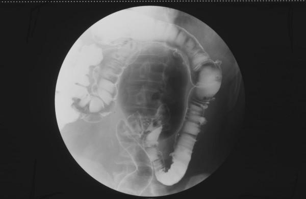 https://cdn.ncbi.nlm.nih.gov/pmc/blobs/ceb4/2803977/48629a26344d/1757-1626-2-9314-4.jpg