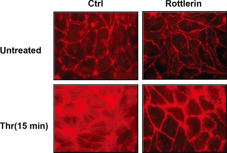 https://cdn.ncbi.nlm.nih.gov/pmc/blobs/ceb6/4956111/111028555b23/pone.0158865.g003.jpg