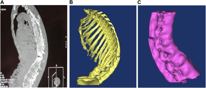 https://cdn.ncbi.nlm.nih.gov/pmc/blobs/ceb9/10523558/d7f3ec9643ec/fbioe-11-1220102-g001.jpg