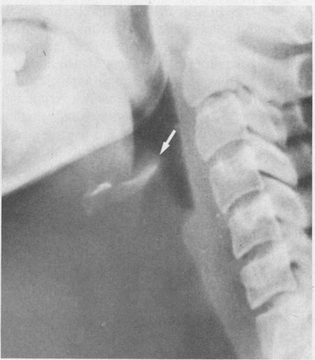 https://cdn.ncbi.nlm.nih.gov/pmc/blobs/ceb9/1271720/9efa6cacf19e/westjmed00240-0067-b.jpg