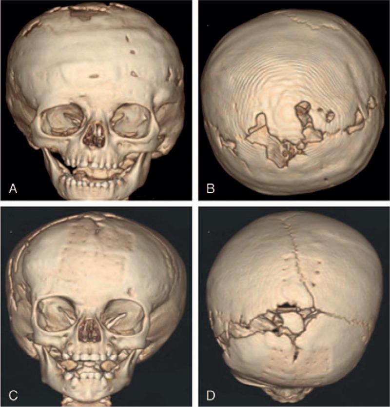 https://cdn.ncbi.nlm.nih.gov/pmc/blobs/cebf/5673299/2250ff0c1b57/jcrsu-28-2108-g002.jpg