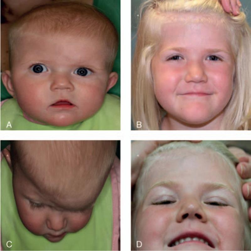 https://cdn.ncbi.nlm.nih.gov/pmc/blobs/cebf/5673299/cc9654c18595/jcrsu-28-2108-g003.jpg