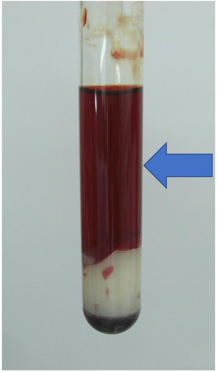 https://cdn.ncbi.nlm.nih.gov/pmc/blobs/cec1/10143116/0d802143ddbc/microorganisms-11-00824-g001.jpg