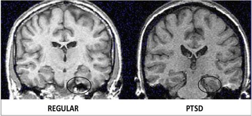 https://cdn.ncbi.nlm.nih.gov/pmc/blobs/cec1/11045199/51e1bf6ad89a/IBRA-10-46-g004.jpg
