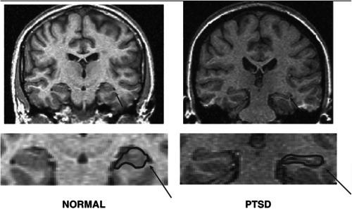 https://cdn.ncbi.nlm.nih.gov/pmc/blobs/cec1/11045199/682c1832204a/IBRA-10-46-g003.jpg