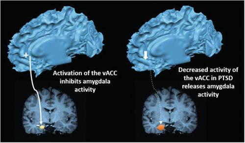 https://cdn.ncbi.nlm.nih.gov/pmc/blobs/cec1/11045199/a0ac710a84f2/IBRA-10-46-g002.jpg