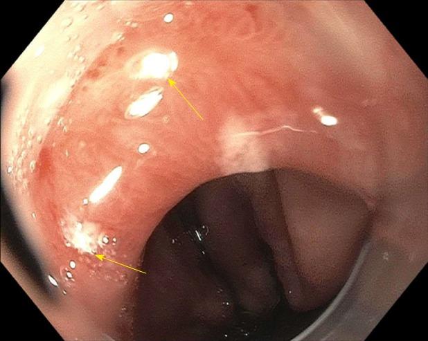 https://cdn.ncbi.nlm.nih.gov/pmc/blobs/cec1/6626724/875fe07083d9/WJG-25-3108-g005.jpg