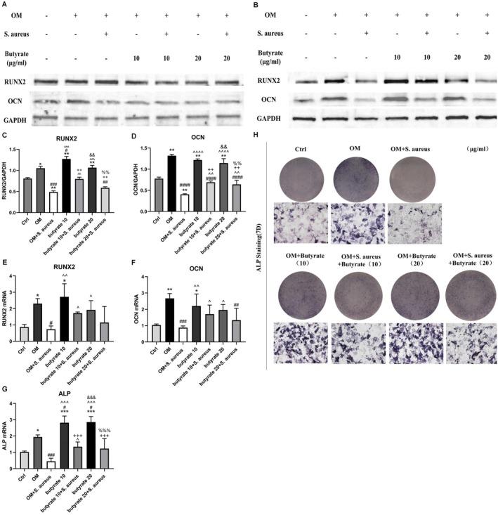 https://cdn.ncbi.nlm.nih.gov/pmc/blobs/cec4/12401135/5e24f25c61dc/JCMM-29-e70683-g006.jpg
