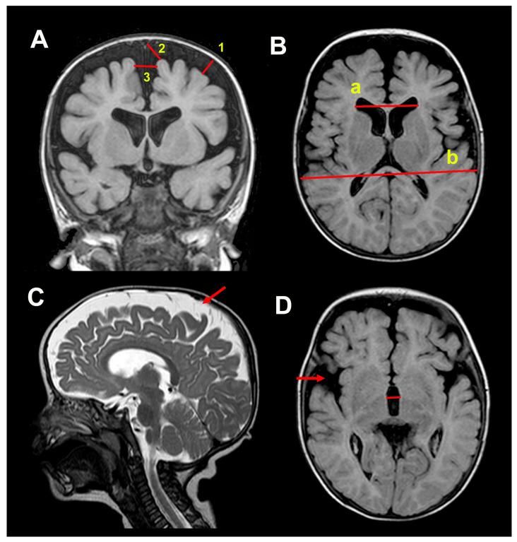 https://cdn.ncbi.nlm.nih.gov/pmc/blobs/cec5/12072479/a1738a6b2c60/jcm-14-03042-g001.jpg