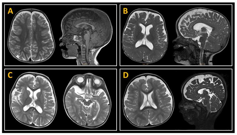 https://cdn.ncbi.nlm.nih.gov/pmc/blobs/cec5/12072479/b53f0d5fdf9b/jcm-14-03042-g004.jpg