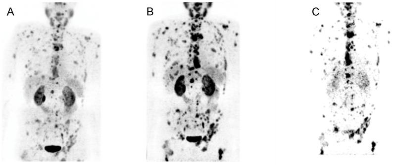 https://cdn.ncbi.nlm.nih.gov/pmc/blobs/cec8/5695136/cc2acf260eba/thnov07p4359g008.jpg