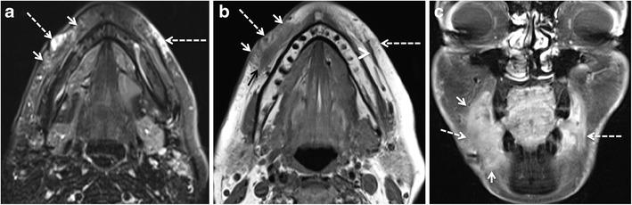 https://cdn.ncbi.nlm.nih.gov/pmc/blobs/cec9/5707222/0f48e1814c87/13244_2017_575_Fig9_HTML.jpg