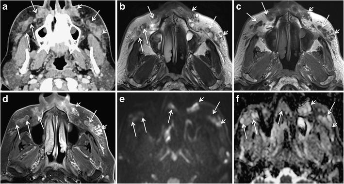 https://cdn.ncbi.nlm.nih.gov/pmc/blobs/cec9/5707222/1376cec13a37/13244_2017_575_Fig8_HTML.jpg