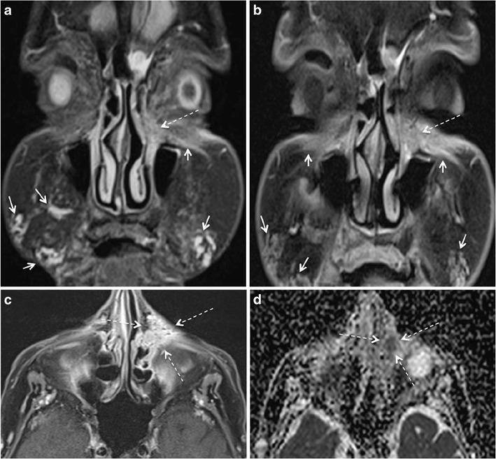 https://cdn.ncbi.nlm.nih.gov/pmc/blobs/cec9/5707222/241dcb6cd383/13244_2017_575_Fig11_HTML.jpg