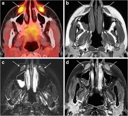 https://cdn.ncbi.nlm.nih.gov/pmc/blobs/cec9/5707222/2e683ca60e89/13244_2017_575_Fig10_HTML.jpg