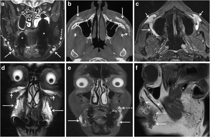 https://cdn.ncbi.nlm.nih.gov/pmc/blobs/cec9/5707222/5da45464afdd/13244_2017_575_Fig5_HTML.jpg