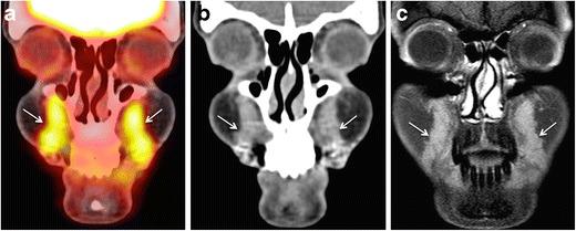 https://cdn.ncbi.nlm.nih.gov/pmc/blobs/cec9/5707222/6752350415c7/13244_2017_575_Fig1_HTML.jpg