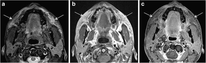 https://cdn.ncbi.nlm.nih.gov/pmc/blobs/cec9/5707222/a16769b7a851/13244_2017_575_Fig7_HTML.jpg