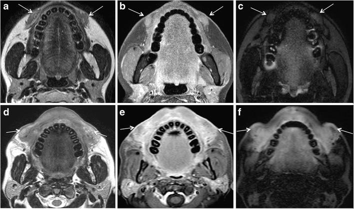 https://cdn.ncbi.nlm.nih.gov/pmc/blobs/cec9/5707222/c1226fabd780/13244_2017_575_Fig6_HTML.jpg