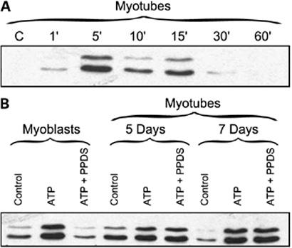 https://cdn.ncbi.nlm.nih.gov/pmc/blobs/ced4/2096538/8026ab292e29/11302_2005_Article_16311_Fig4.jpg